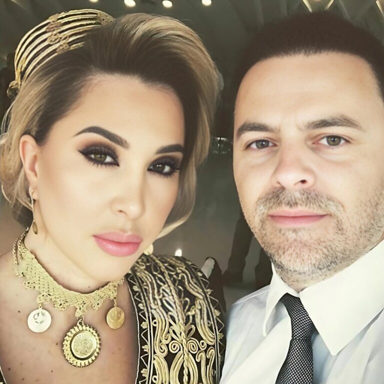 “Më goditi disa herë në kokë”/ Këngëtarja Teuta Selimi kallëzon për dhunë bashkëshortin: Sulm fizik dhe nga vëllai