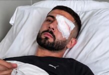 U plagos në protestë: Operacioni në Romë i shpëton syrin Erjon Vishkullit.